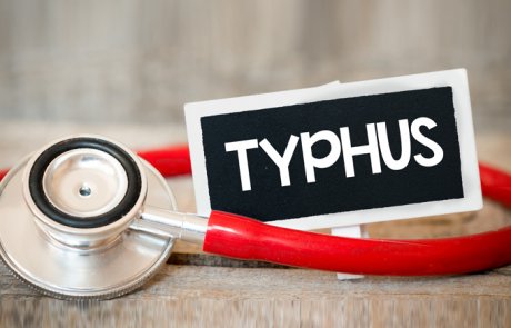 טיפוס מוריני – murine typhus